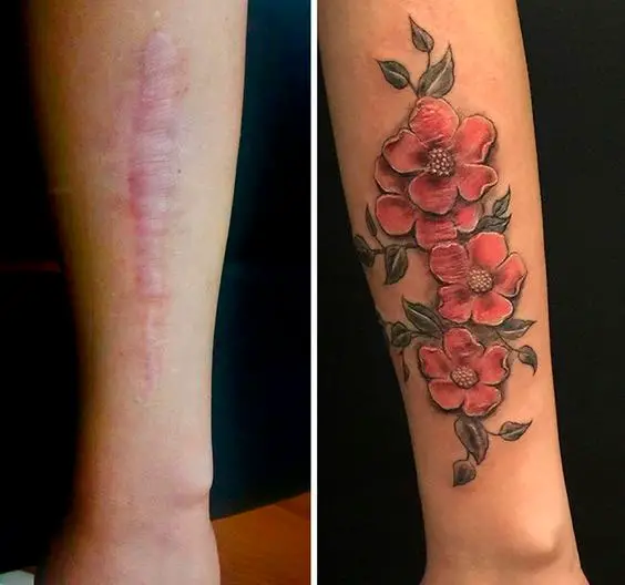 Tatuagem para esconder cicatriz na perna